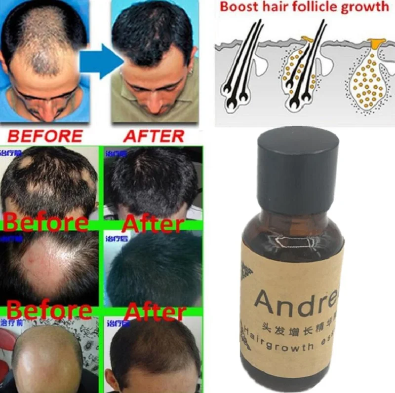 Andrea Hair Growth Ginger Oil Natural Plant Essence Faster Grow Beard Eyelashes Hair Tonic Shampoo Hair Loss Hair Care set