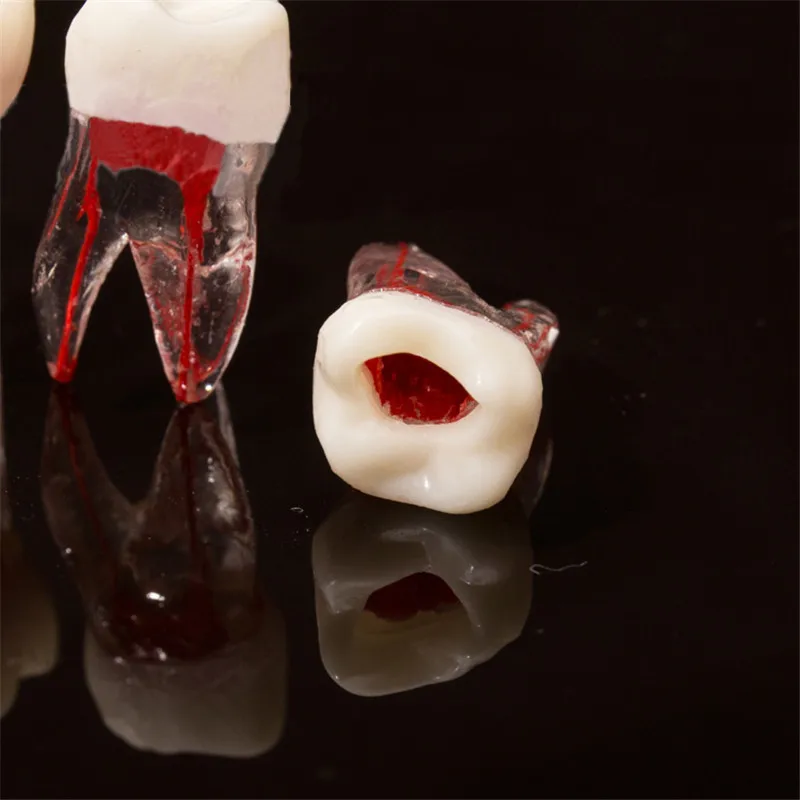1Pc Dental Tooth model Root Canal RCT Practice Pulp Cavity Clear  Resin Teaching teeth model 1:1 Dental Model Dentist Tools