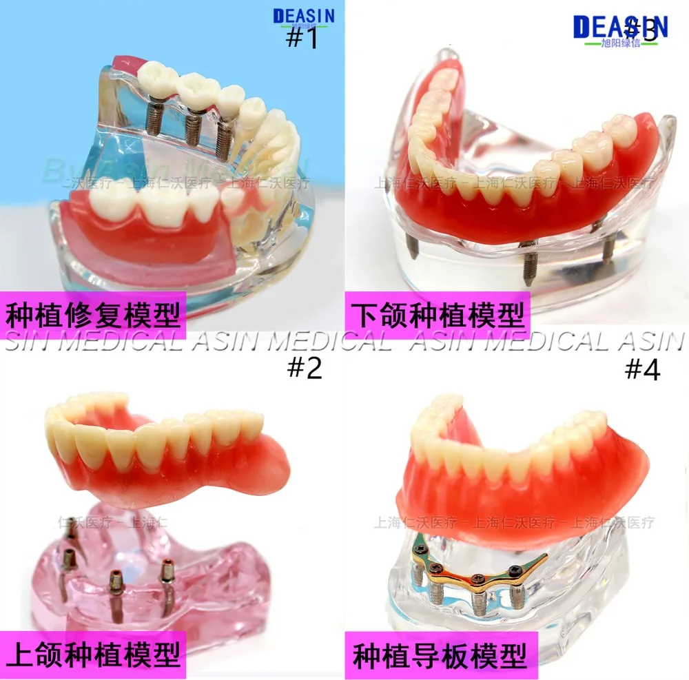 

1 pc x high quality Resin Coverage dental implant model dentures Removable teeth model for dentist study Deasin