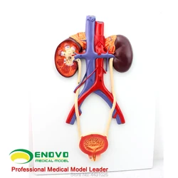 Enovo Menselijk Urinewegen Model Ureteral Urethrale Model Nier Anatomie Model Geneeskunde