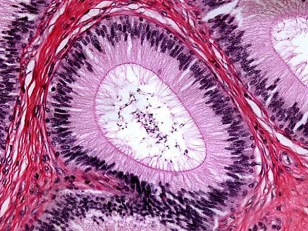 Binocular Compound Microscope--AmScope Supplies 40X-2000X Infinity Kohler Plan Achromatic Binocular Compound Microscope