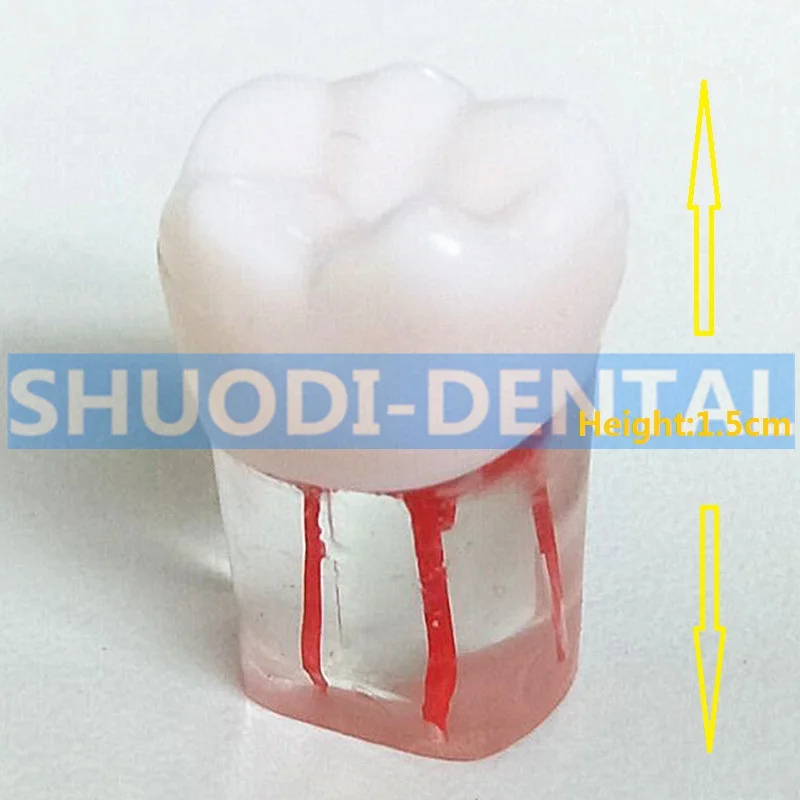 

1:1 полимерная Стоматологическая эндодонтическая модель для обучения студентам, операционная модель с цветной целлюлозой корневого канала, стоматология, лабораторные модели, материалы