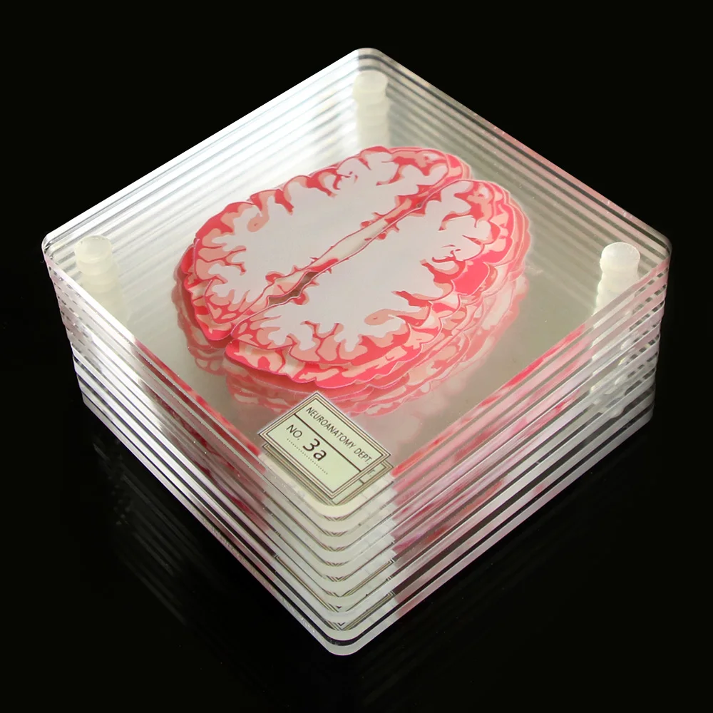 Brain Specimen Coasters Set 3D Organ Brain Artwork Brain Slices Square Acrylic Glass Drinks Table Coaster Drunk Scientists Gift