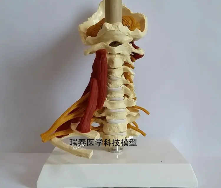 Cervical spine Carotid artery Intervertebral disc and neural teaching model