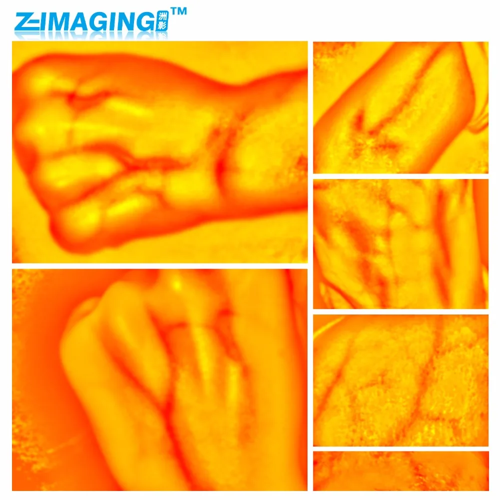 Adults Children Suitable Vein Viewer Display Lights Imaging Find Vein Medical Vein Finder Vein Viewer