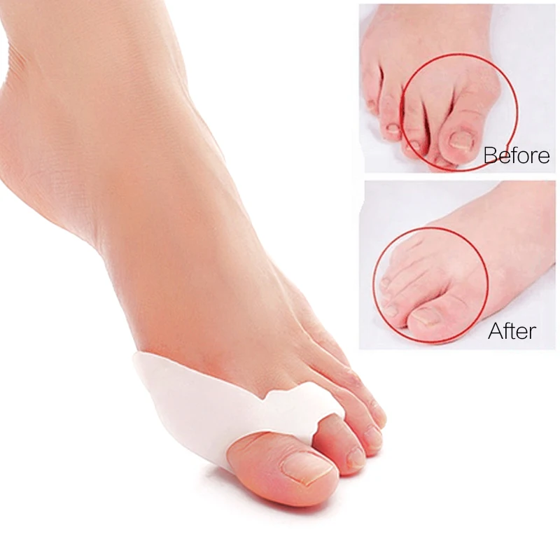 Bone Thumb Corrector Foot Care Tools Bunion Corrector Toe Separators Hallux Valgus Stretcher Correction of the Thumb Adjuster