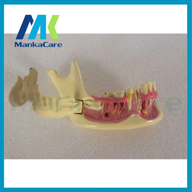 Manka Care - Advanced Simulation Model of Mandibular Tissue Decomposition,Simulation Model of Mandibular Structures