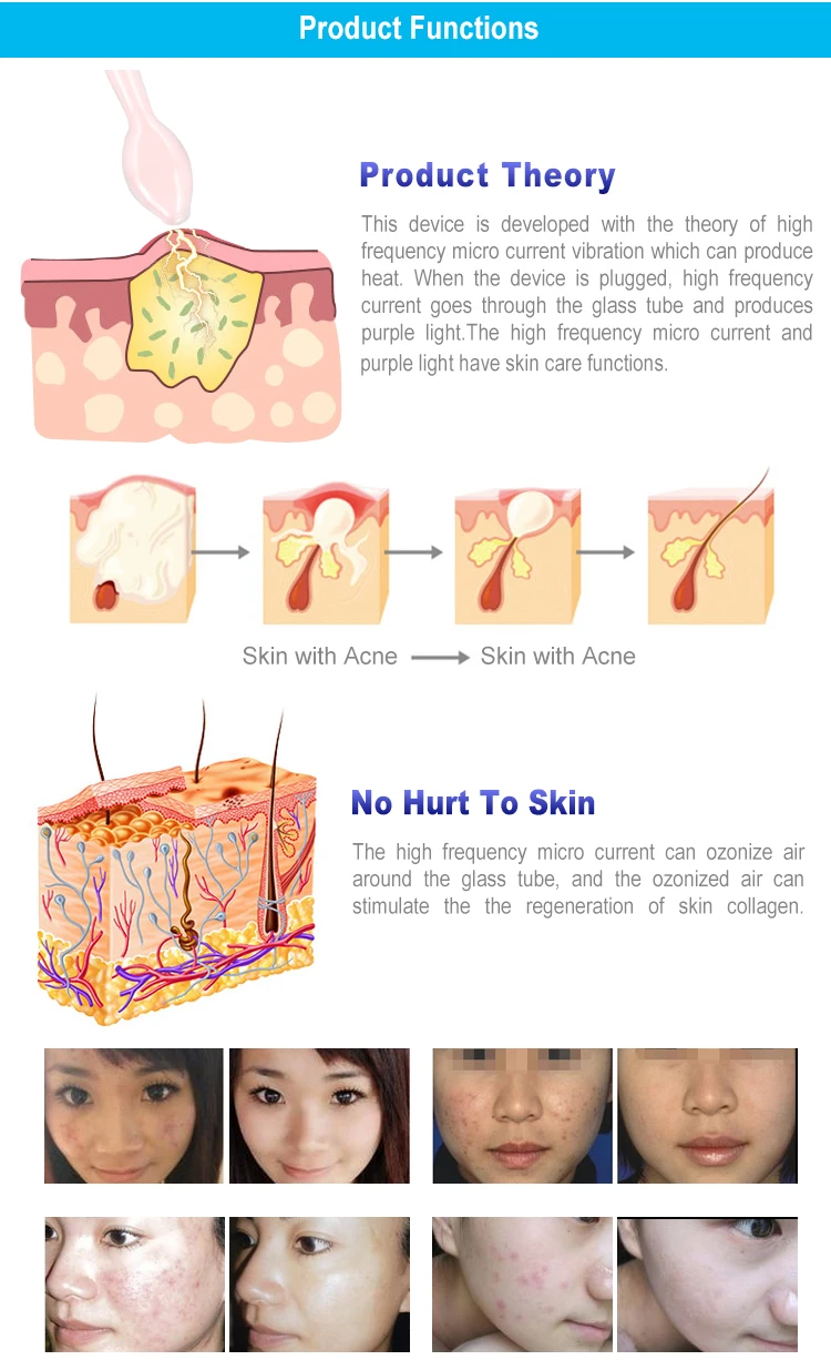 المحمولة القطب عالية التردد بقعة حب الشباب مزيل جهاز العناية بالوجه مدلك للوجه الجمال جهاز سبا صالون المنزل