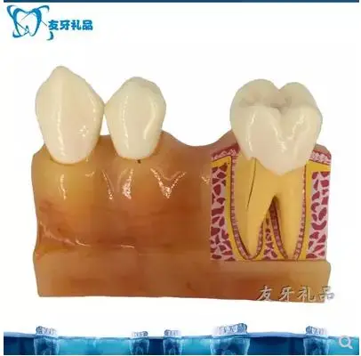 Four times the teeth decompose the tooth model explains the pulp and anatomy of the oral cavity model