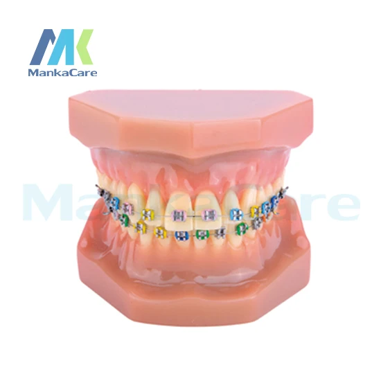 Dental Orthodontic Treatment Model With Ortho Metal Bracket Arch Wire Buccal Tube Ligature Ties metal bracket Oral Model