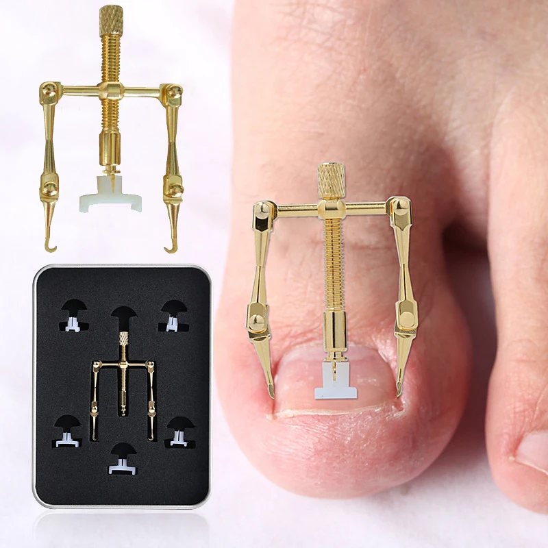 

Alwafore Ingrown Toe Nail Correction Tool Fixer Recover Toe Paronychia Nail Brace Tools Ingrown Toenails Pedicure Tool