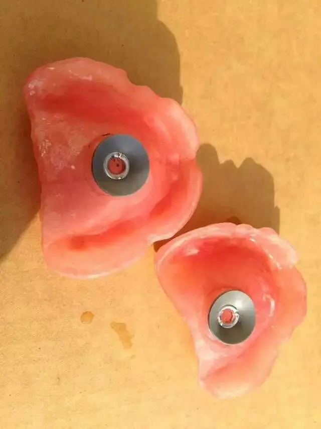1Set Dental Lab Dental Sucker Denture Plate Retention For Full Upper Denture or Acrylic Partial Denture