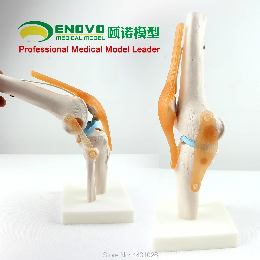 

Enovo Medical Human Functional Knee Ligament Model Knee Model Orthopedic Teaching