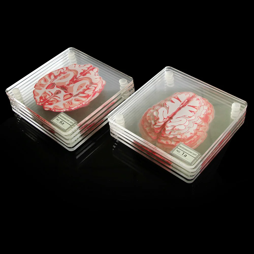 Brain Specimen Coasters Set 3D Organ Brain Artwork Brain Slices Square Acrylic Glass Drinks Table Coaster Drunk Scientists Gift