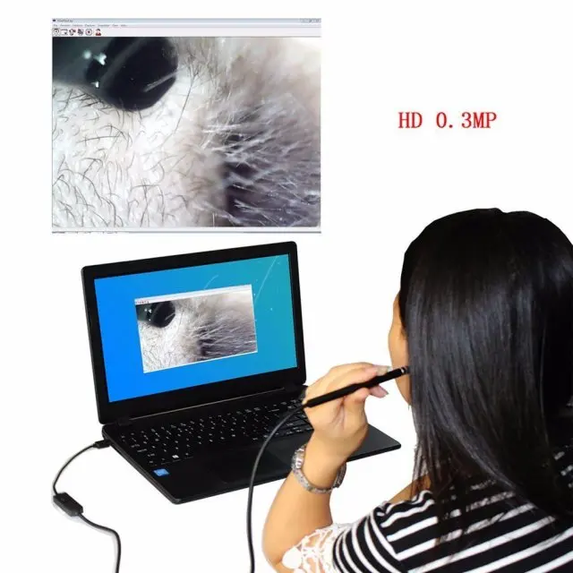 2-In-1 Usb Multifunctionele Endoscoop Borescope Voor Oor Schoonmaken, neusholte En Keel Inspectie Met Oor Picks