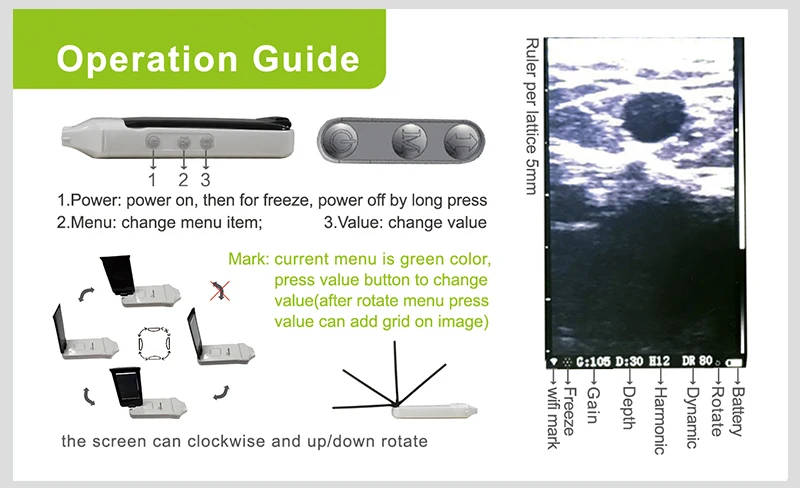 Xprobe série built-in tela tipo sonda sem fio ultra-som scanner de exibição na tela embutida e tablet