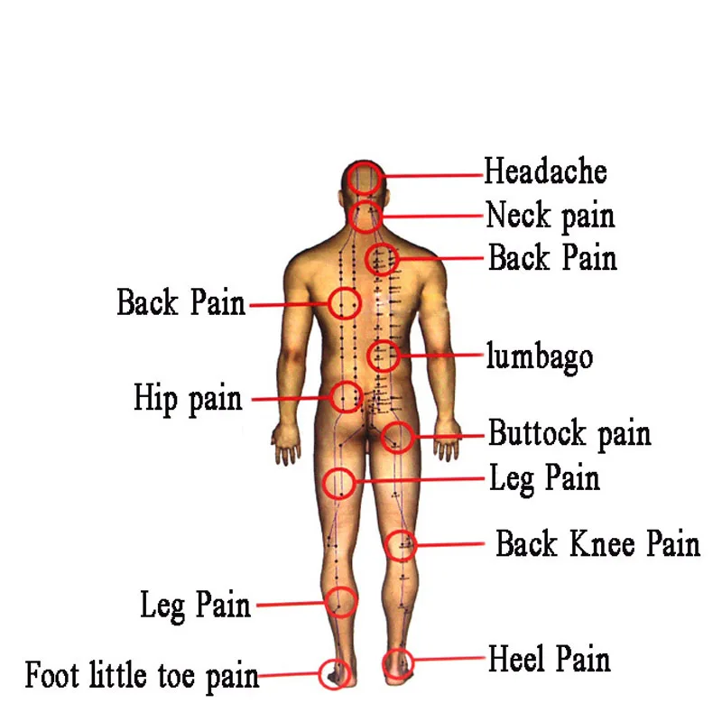 Chinese Medical Hot Capsicum Pain Relief Plaster For Knee Joints Pain Relieving Porous Chilli Patch Back Muscle Pain, Wrist Pain