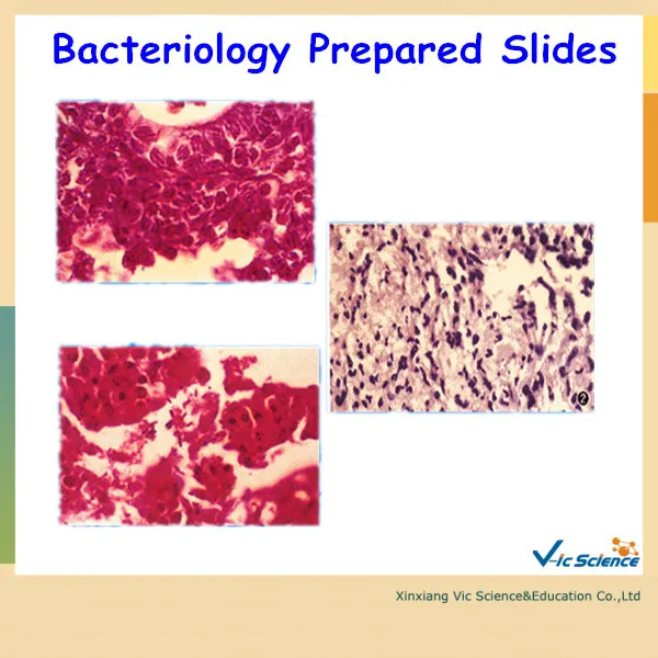 25pcs Bacteriology Prepared Slides