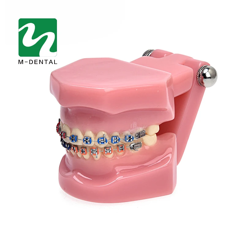 

1PC Dental Orthodontic Study Model Teeth Orthodontic Model With Metal Brackets For Teaching High Quality