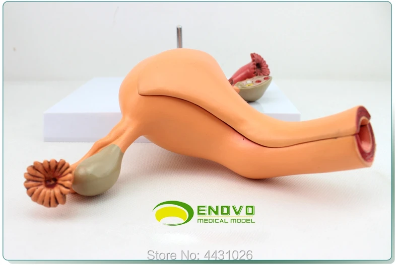 ENOVO Model of obstetrics and gynecology of reproductive organs in female reproductive organs in medical women