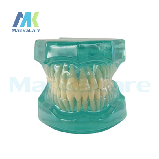 Manka Care -  28 pcs Tooth, Clear Model Without bracket Oral Model Teeth Tooth Model