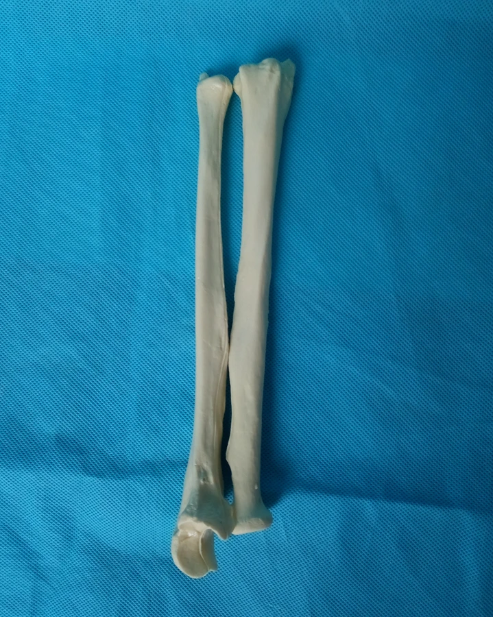 1 Pair Left and Right Human 1:1 Radius Model Medical Teaching Model Radius Cortical Bone Humans Skeleton Model Medical Specimen