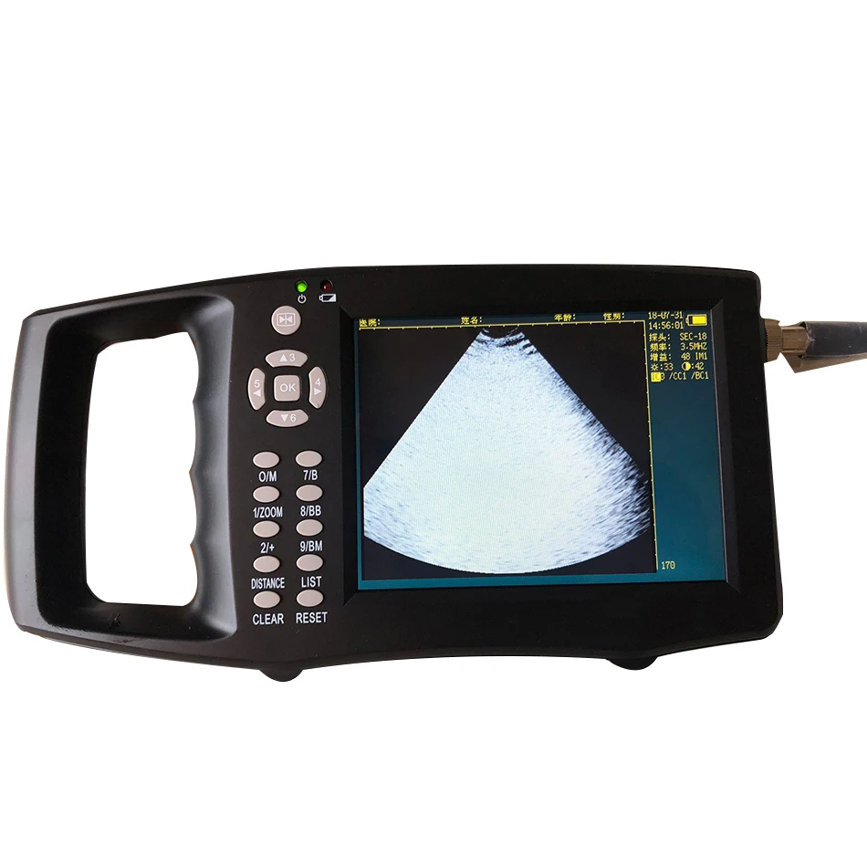 

SN5000-B Veterinary B-ultrasound Pig B-machine Cattle and Sheep Sow Pregnancy Test Horse