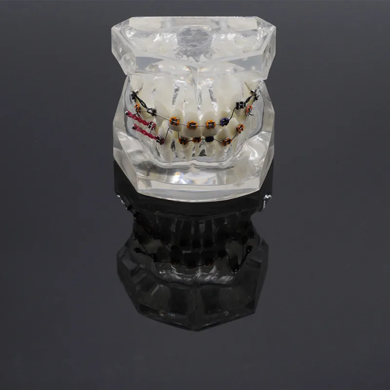 

Dentist Lab Tooth Orthodontic Model Malocclusion Models Teaching Model Transparent