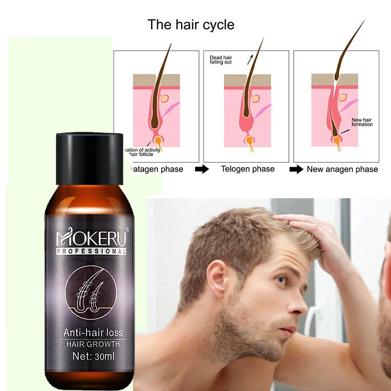 Mokeru 2pc/Lot 30ml Natural Hair Growth Products Organic Anti Hair Loss Baldness Treatment Herbal Hair Regrowth Oil for Man