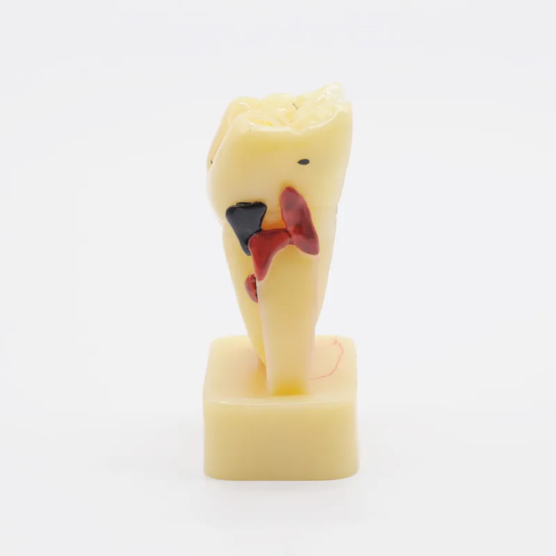 

Dentistry Lab Equipment Study Teach Tooth Model Teeth Disease Model