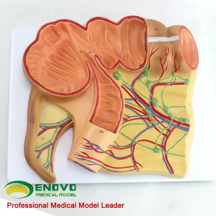 Ileocecal anatomy model of human body; caecum appendix ascending node ileal vascular lymphatic model; The medical model