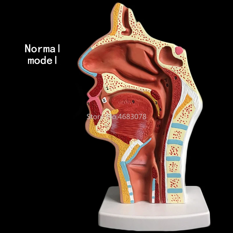 Normal/pathological Anatomy model of the nasopharyngeal cavity in the nasal cavity and throat of human body 24x12x12cm