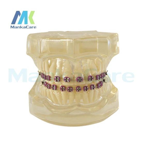 Manka Care -  28 pcs Tooth, all metal bracket Oral Model Teeth Tooth Model