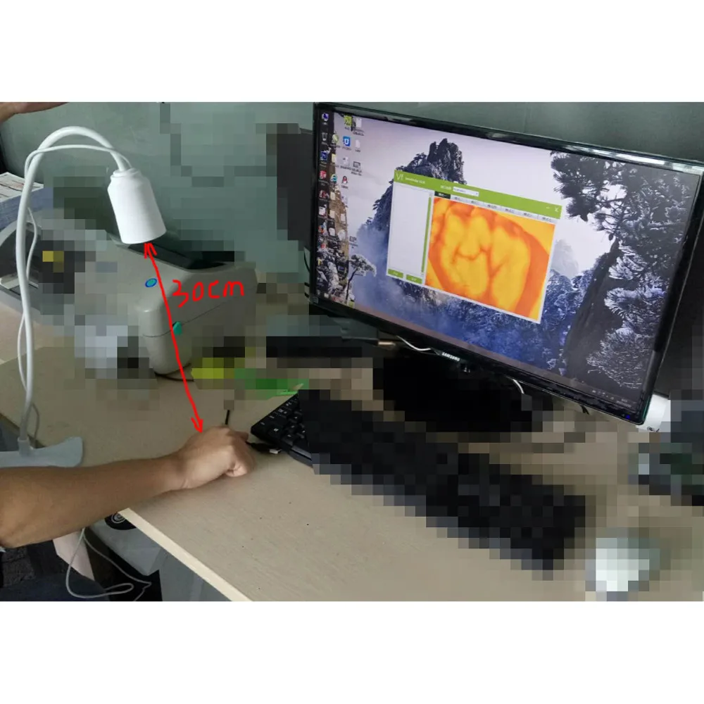 Adults Children Suitable Vein Viewer Display Lights Imaging Find Vein Medical Vein Finder Vein Viewer