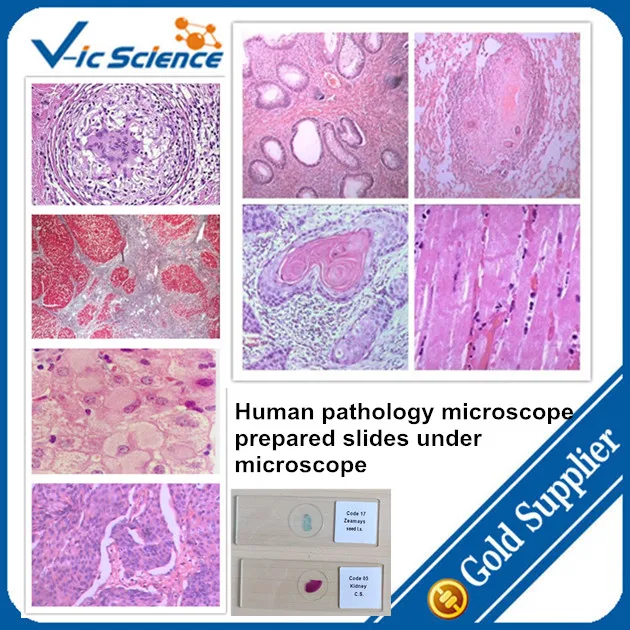 Human pathological organs and histology prepared slides,pathological organs slides,human organs slides