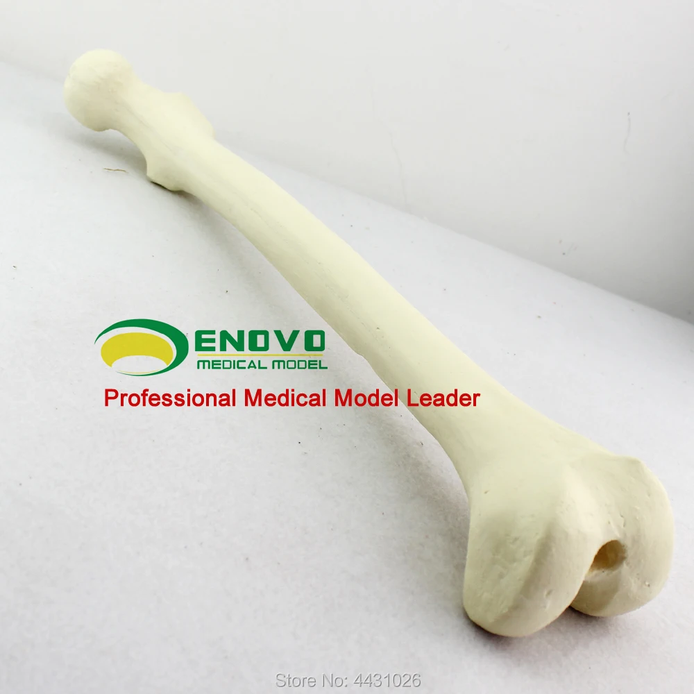 ENOVO The Orthopaedic Pfna Operation Sawbone Artificial Cortical Bone Cancellous Femoral Model Orthopedic Implant Surgery