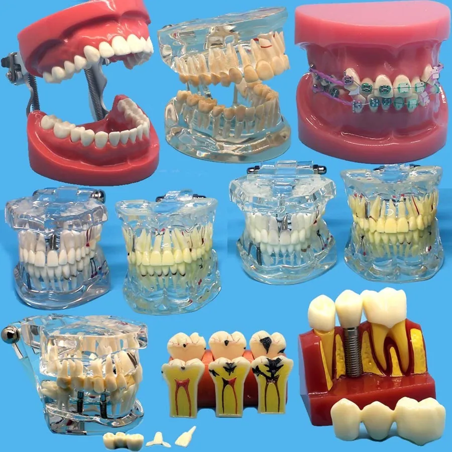 

Various Dental Teeth Models Are Used For Teaching And Hospital Dentist Material