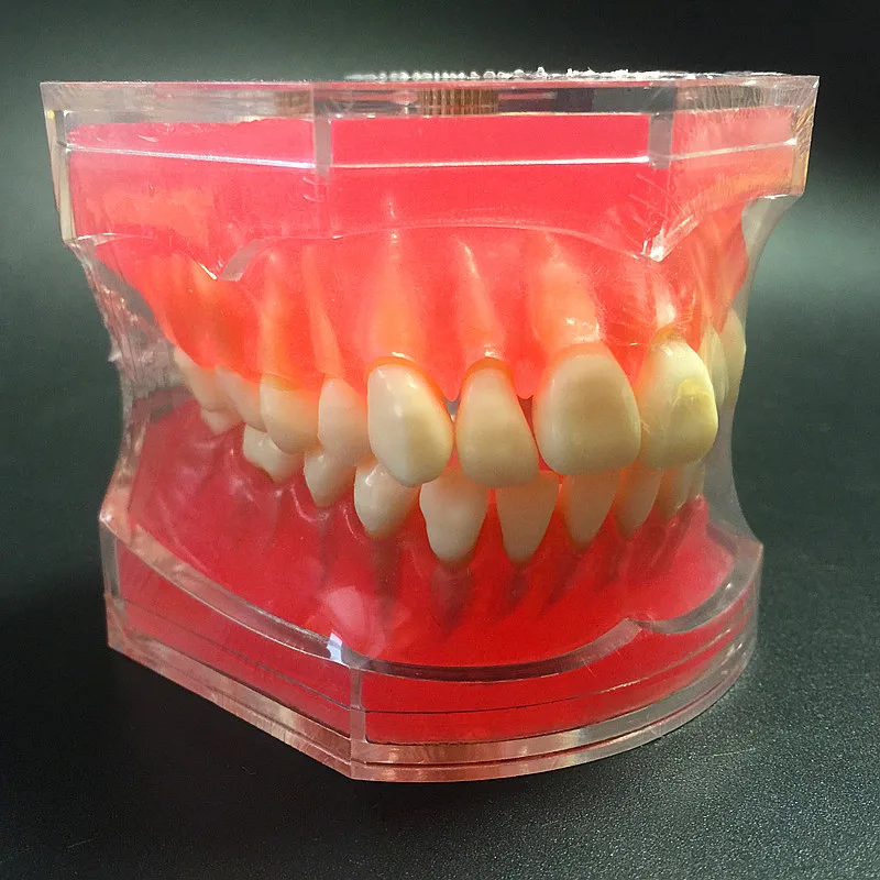 Dental Study Teaching Model Standard Model Removable Teeth Soft Gum ADULT TYPODONT Model