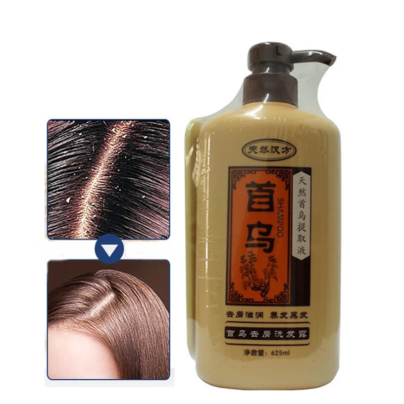 Professional Natural Chinese Medicine Extract Hair Shampoo Nourishing Anti Hair Loss Dandruff Shampoo Hair Care Products 625ML