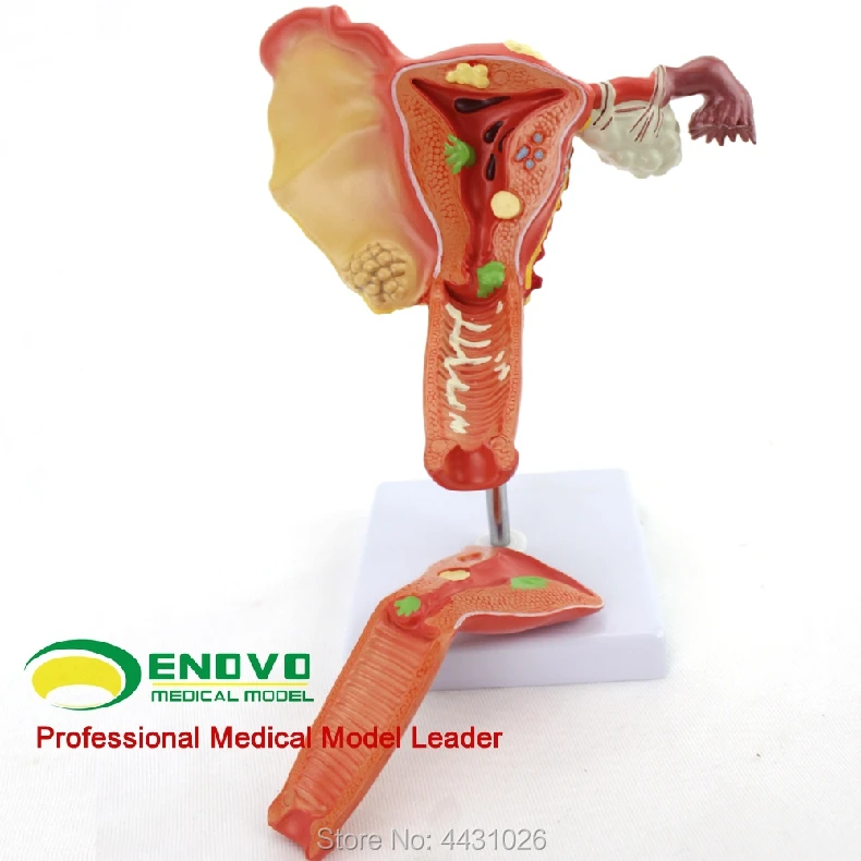 ENOVO Gynecology and obstetrics for gynecology and gynecology