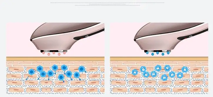 Anion Sonic Hot Cold Face Massager Beauty Skin Care Vibration Anti-aging Firming Anti-wrinkle Spa Machine Rechargeable