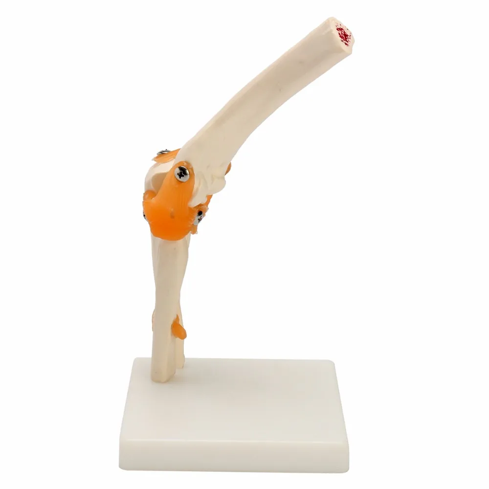 Human Elbow Joint Model Anatomical Anatomy Elbow Joint Medical Model Orthopedics
