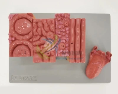 Human tongue anatomical model Tongue , tongue nipple, taste bud, oral digestion, tongue tissue