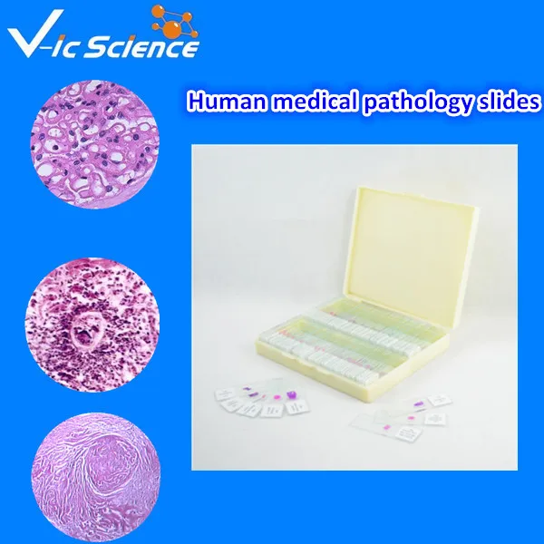 100pcs Human medical pathology slides