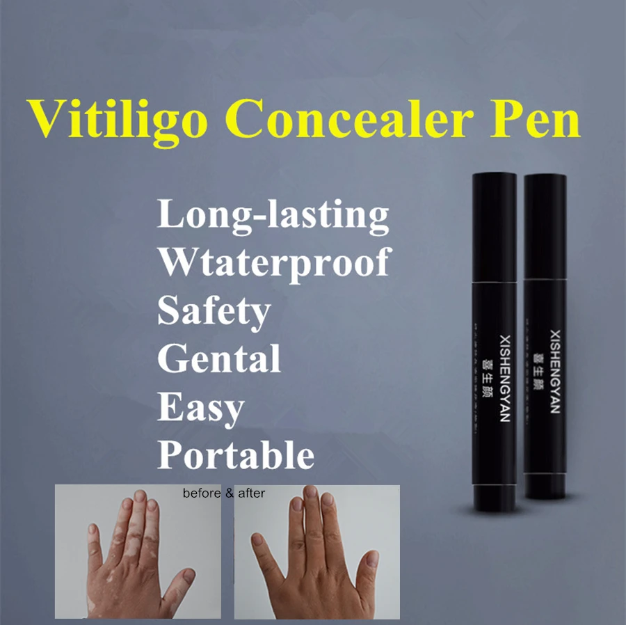 Vitiligo Leukoderma Covering Pen Waterproof Concealer Cream Liquid Women Men Face Discolored Skin White Spot Patches Makeup