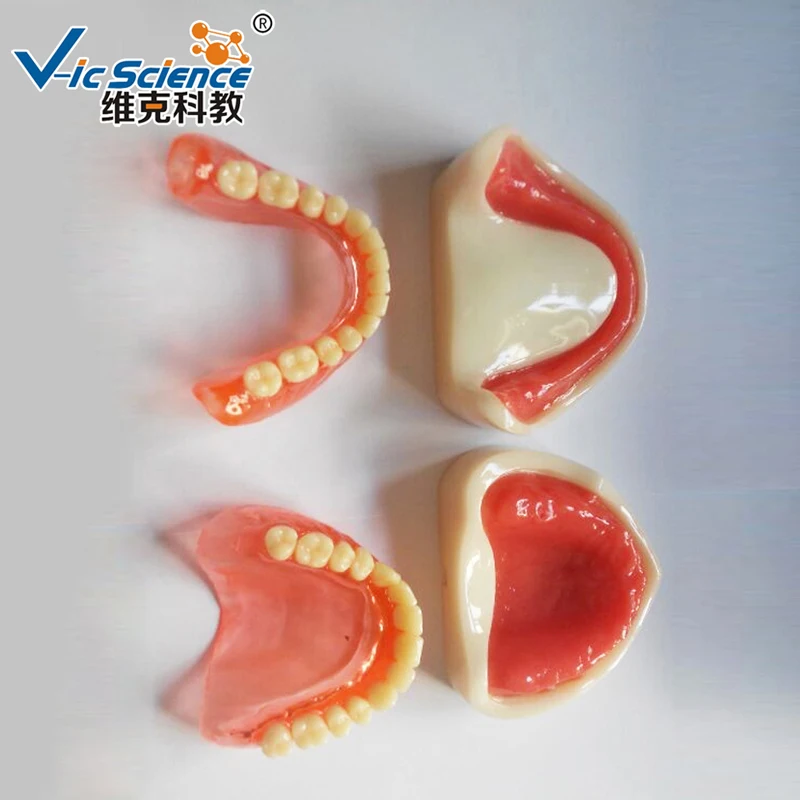 Modello di Impianto di Protesi Totale/Modello di Impianto/Protesi Dentale Denti Modello