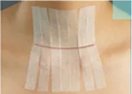 1pcs 6mm 12mm*100mm foreign trade health seam-free beauty tape surgery postpartum skin wound strip pull tight anti-speed