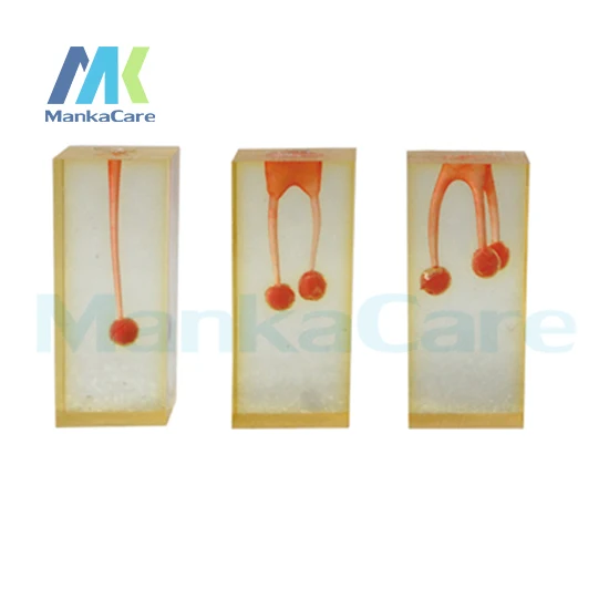 

Manka Care - 3 Pcs Dental Canal Teeth with colored pulpal wall. Root with silicone rubber ball Oral Model Teeth Tooth Model