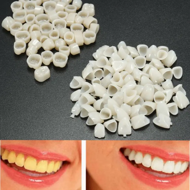 120pcs Dental Material Teeth Mixed Temporary Crown 70pcs Anteriors Front Tooth 50pcs Molar Posterior Veneers Teeth Dentist Tool