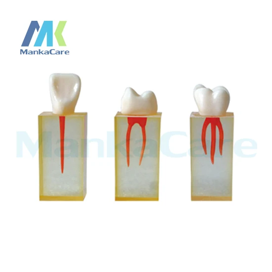 Manka Care - 3 pcs Teeth with colored pulpal wall and crowns.Excellent for developing access opening and endo filling procedures